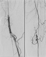 Abbildung 2: Reentry