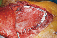 Abbildung 1: Thoraxwand