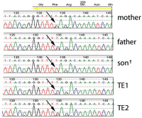 Abbildung 4: PGD for Spinal Muscular Atrophy, SMA