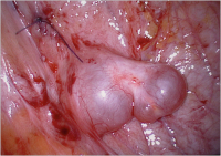 Abbildung 1: Spontaneous follicular development