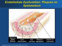 Abbildung 7: Endotheliale Dysfunktion