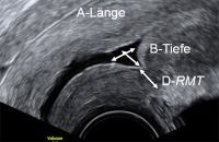 Abbildung 4: Gyn-Ultraschall