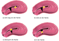 Abbildung 5: Gyn-Ultraschall