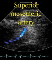 Figure 2: Intrakardiale Echokardiographie