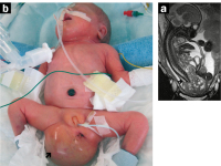 Abbildung 9a-b: Pränataldiagnostik-Therapie