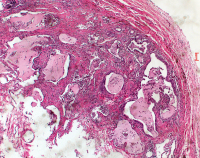 Abbildung 2: Trommelschlägelfinger