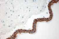 Abbildung 4: Endodermale Zyste