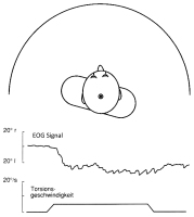 Abbildung 3: Zerviko-okulärer-Reflex
