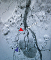 Abbildung 1: Beckenübersicht
