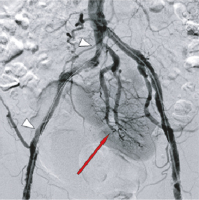 Abbildung 3: Beckenübersicht