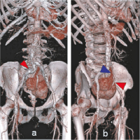 Abbildung 4a-b: Thorax - Becken
