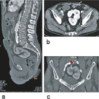 Abbildung 5a-c: Kuchenniere