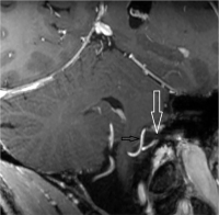 Abbildung 1: 7-Tesla-MRT