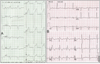 Abbildung 48: Alternierender Schenkelblock