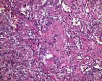 Abbildung 2: DAD - EVALI