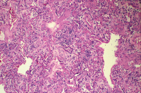 Abbildung 3: DAD - EVALI