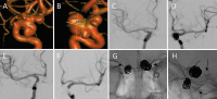 Abbildung 7A-H: Intrakranielles Aneurysma