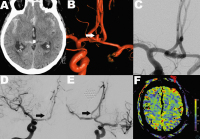 Abbildung 4: Hybrid-Eingriff