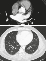 Abbildung 3: Computertomographie
