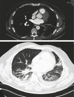 Abbildung 4: Computertomographie