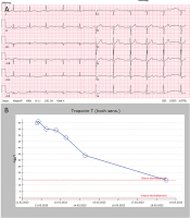 Abbildung 7: Troponin T - Print-Abbildung 4