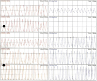 Abbildung 1: Pulsoszillographie