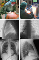 Abbildung 1: Dissektion