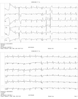 Abbildung 4: Low-Pass-Filterung