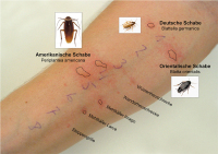 Abbildung 4: Hauttest