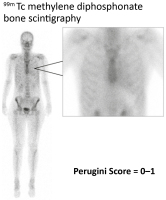 Abbildung 3: 99mTc-Szintigraphie