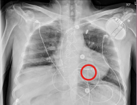 Abbildung 1: Röntgen