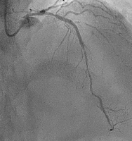 Abbildung 2: Angiography