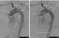 Abbildung 2: Angiegraphie