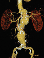 Abbildung 2: 3D-Modell