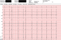 Abbildung 3: EKG