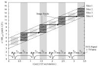 Figure 1: Computertomographie - Bildrekonstruktion