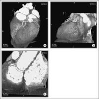 Figure 4a-c: MCDT - Computertomographie
