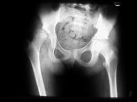 Abbildung 5: Hüftgelenk