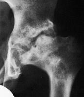 Abbildung 6: Hüftgelenk