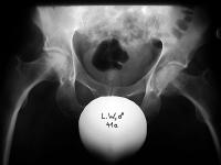 Abbildung 14: Hüftgelenk