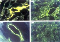 Figure 6: Adenosin und koronare Mikrozirkulation