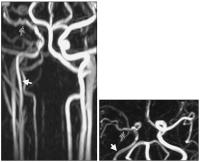 Abbildung 1: Arteria carotis - Perfusion