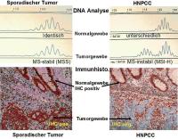 Abbildung 1: Kolonkarzinom - HNPCC-Syndrom