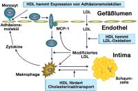 Abbildung 1: HDL - Atherosklerosehemmung