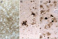 Abbildung 3a-c: Spongiforme Enzephalopathie - Prionprotein
