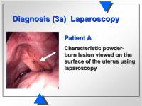 Abbildung 7: Diagnose - Laparoskopie