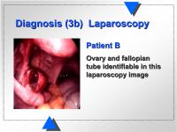 Abbildung 8: Diagnose  - Laparoskopie