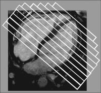 Abbildung 1: Kardiale Magnetresonanztomographie