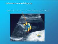 Abbildung 4: Nabelschnurumschlingung