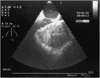 Abbildung 10-a: Postoperative Veränderungen